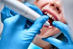 Gum Disease Treatment in Surrey: How Our Hygienists Can Help